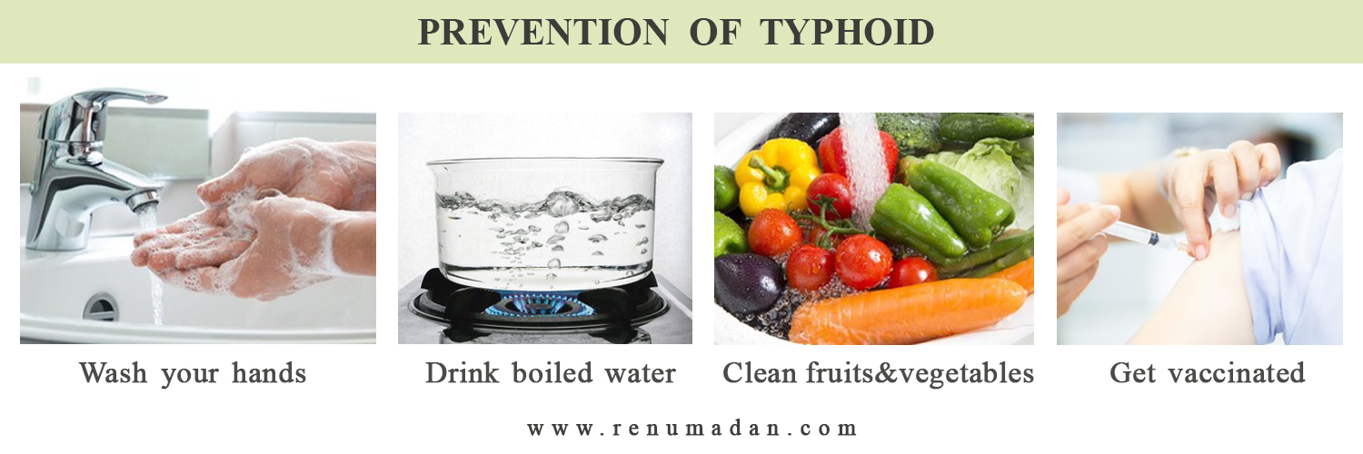 typhoid.jpg