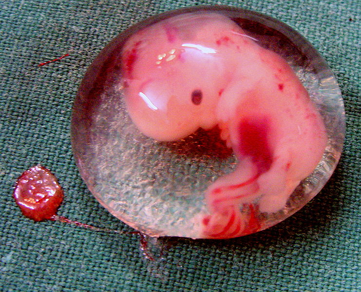 741px-Human_Embryo_-_(cropped).jpg