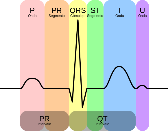 EKG_Complex_es.svg.png