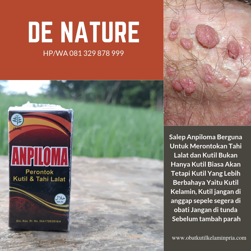 salep kutil kelamin di apotik.jpg