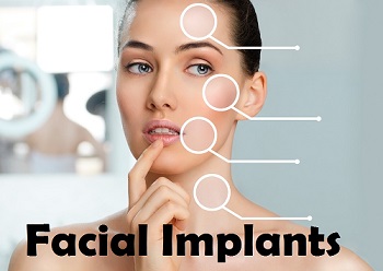 Facial Implants Market.jpg