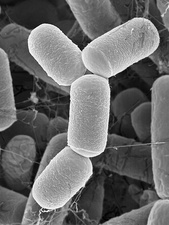 C0369969-Intestine_archaea_Methanobrevibacter_smithii,_SEM.jpg
