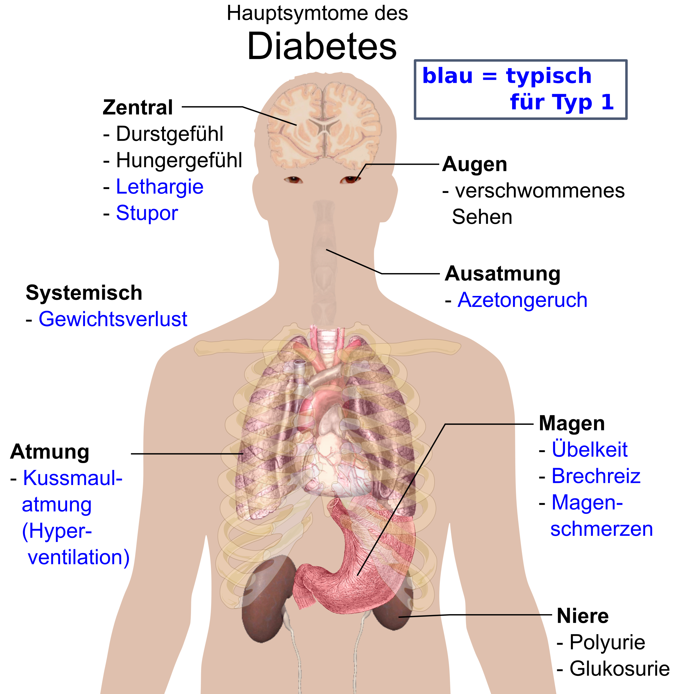 Main_symptoms_of_diabetes-de.png